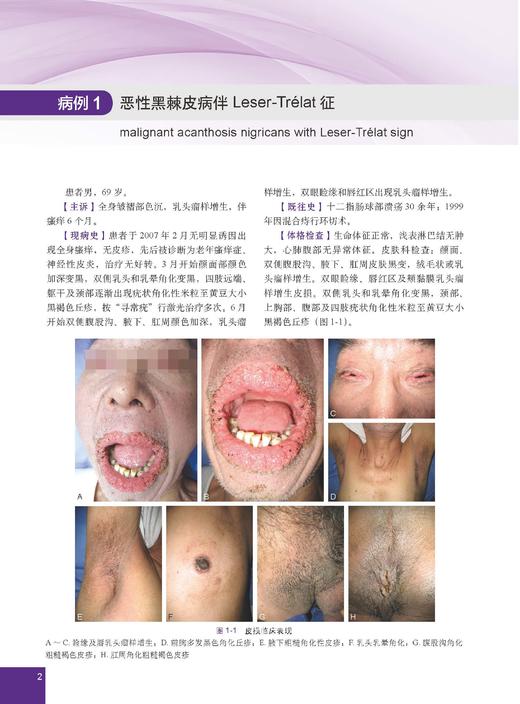 少见及疑难皮肤病病例精粹——临床与病理 陈思远 编 9787030866882 商品图5