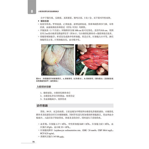 内科疑难罕见病例精粹AI智能体协同实训 段丽萍 系统呈现从病情介绍检验检查诊断治疗到随访预后的完整临床路径北京大学医学出版社 商品图4