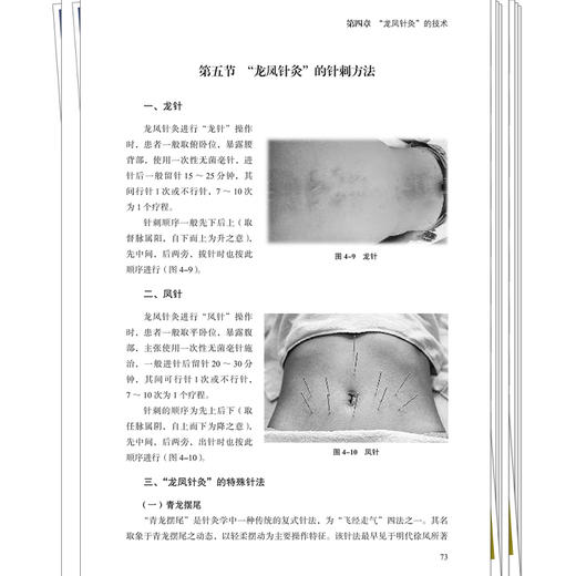 龙凤针灸 伍利民 粟龙 主编 特色针灸治疗技术 可供广大中医针灸工作者、爱好者阅读、学习和参考 9787524708889中国中医药出版社 商品图4