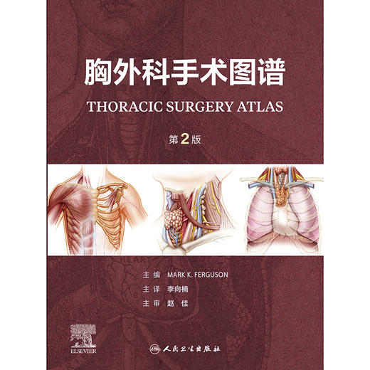 胸外科手术图谱，第2版 商品图1