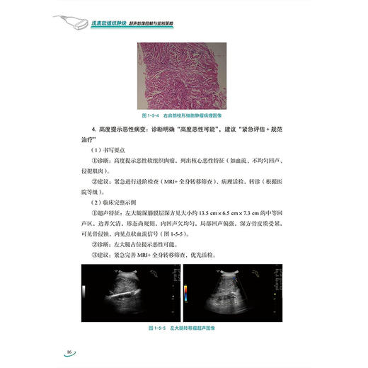 浅表软组织肿块 超声影像图解与鉴别策略 吕淑懿 许伶俐 全书始终秉持 以共识为纲 以病例为证 9787523538623科学技术文献出版社 商品图4