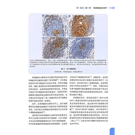 外周T细胞淋巴瘤 王亮 许彭鹏 主译 全面且系统地涵盖了外周T细胞淋巴瘤的各个关键层面 9787523531419 科学技术文献出版社 商品图4