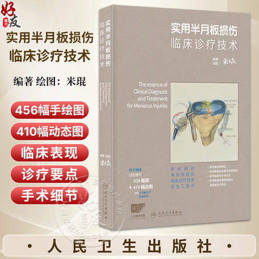 实用半月板损伤临床诊疗技术 配增值 米琨 编著绘图 系统阐述半月板损伤临床诊疗技术专业工具书 9787117403986人民卫生出版社 商品图0