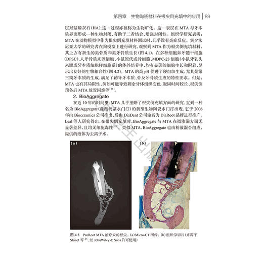 生物陶瓷材料在牙髓病学中的应用 翻译版 张文云 余擎 李潇 主译 为读者提供了全面的理论知识和实践指导 临床医学 人民卫生出版社 商品图4