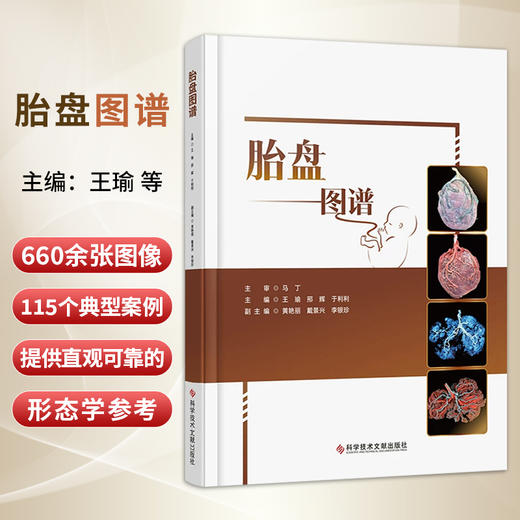 胎盘图谱 王瑜 邢辉 于利利 主编 涵盖胎盘的基本知识 如胎盘的起源、发育、形态结构、生理功能等内容 科学技术文献出版社 商品图0