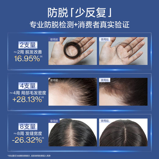 【根源防护 清爽不腻】EHD 防脱密发精华液 温和配方 适配油性头皮 商品图1