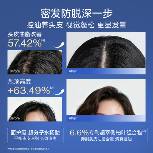 【根源防护 清爽不腻】EHD 防脱密发精华液 温和配方 适配油性头皮 商品图4