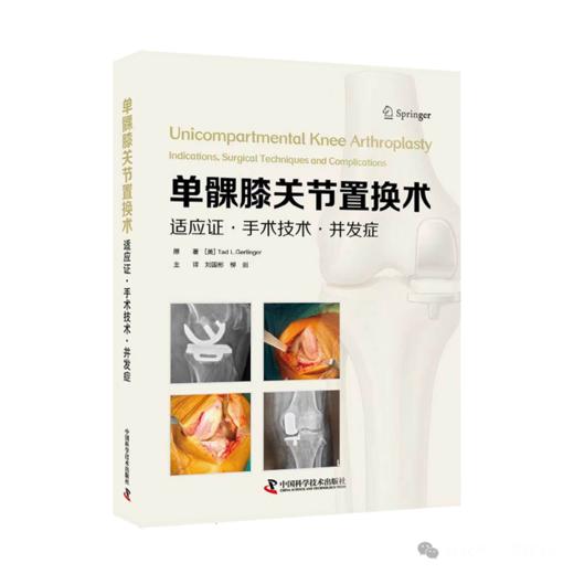 单髁膝关节置换术 : 适应证·手术技术·并发症  主译   刘国彬  柳剑   辽科出版 商品图0
