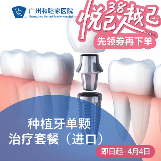 种植牙单颗治疗套餐（进口） DENT07_口腔科 商品图0