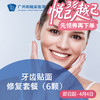 牙齿贴面修复套餐（6颗） DENT09_口腔科 商品缩略图0